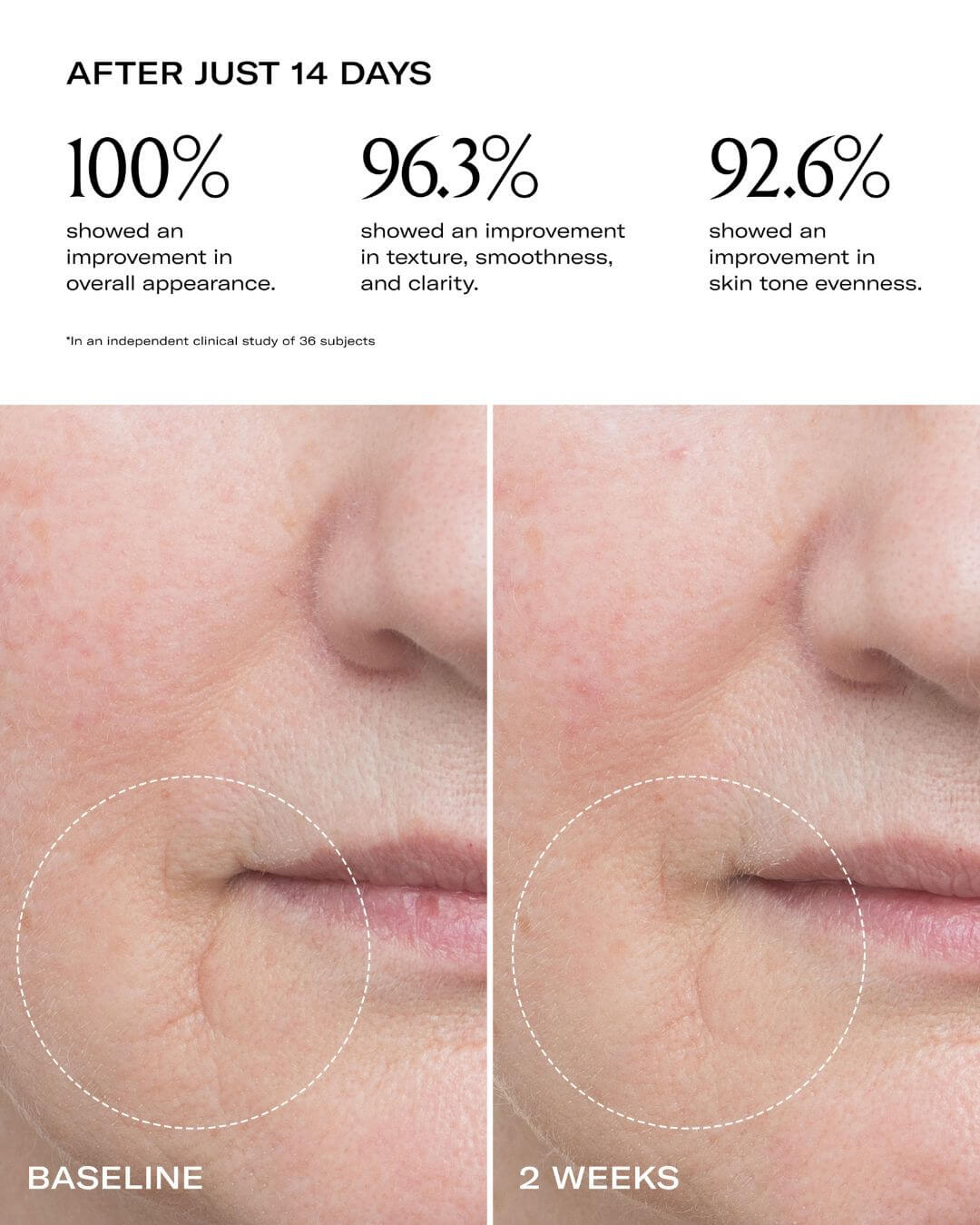 Le Prunier Plum Beauty Oil before after mouth