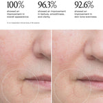 Le Prunier Plum Beauty Oil before after mouth