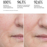 Le Prunier Plum Beauty Oil before after mouth