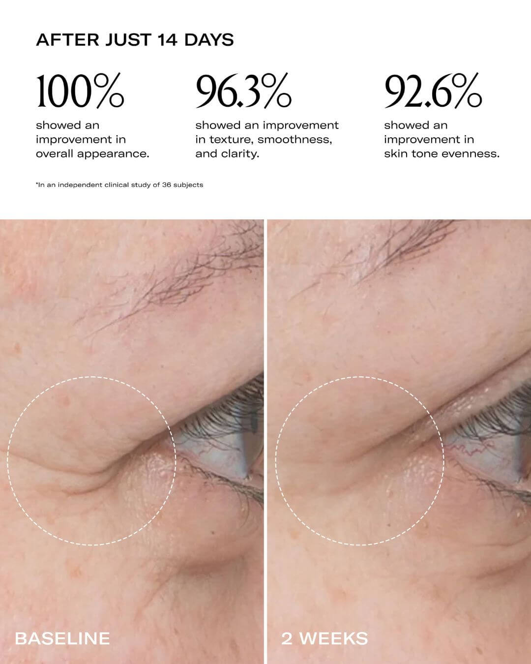 Le Prunier Plum Oil before and after eyes