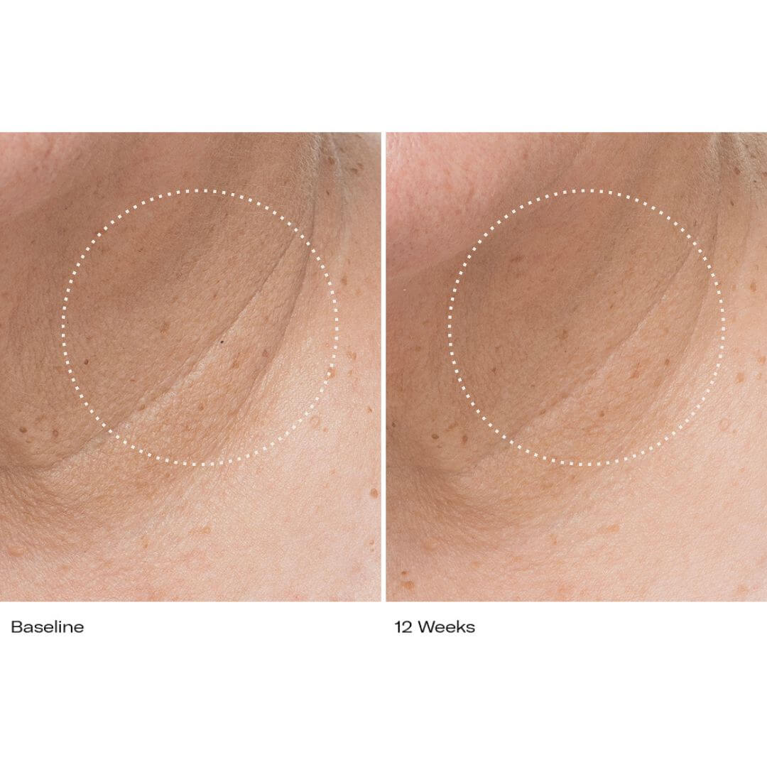 Le Prunier Plumbody Results on wrinkles at 12 weeks