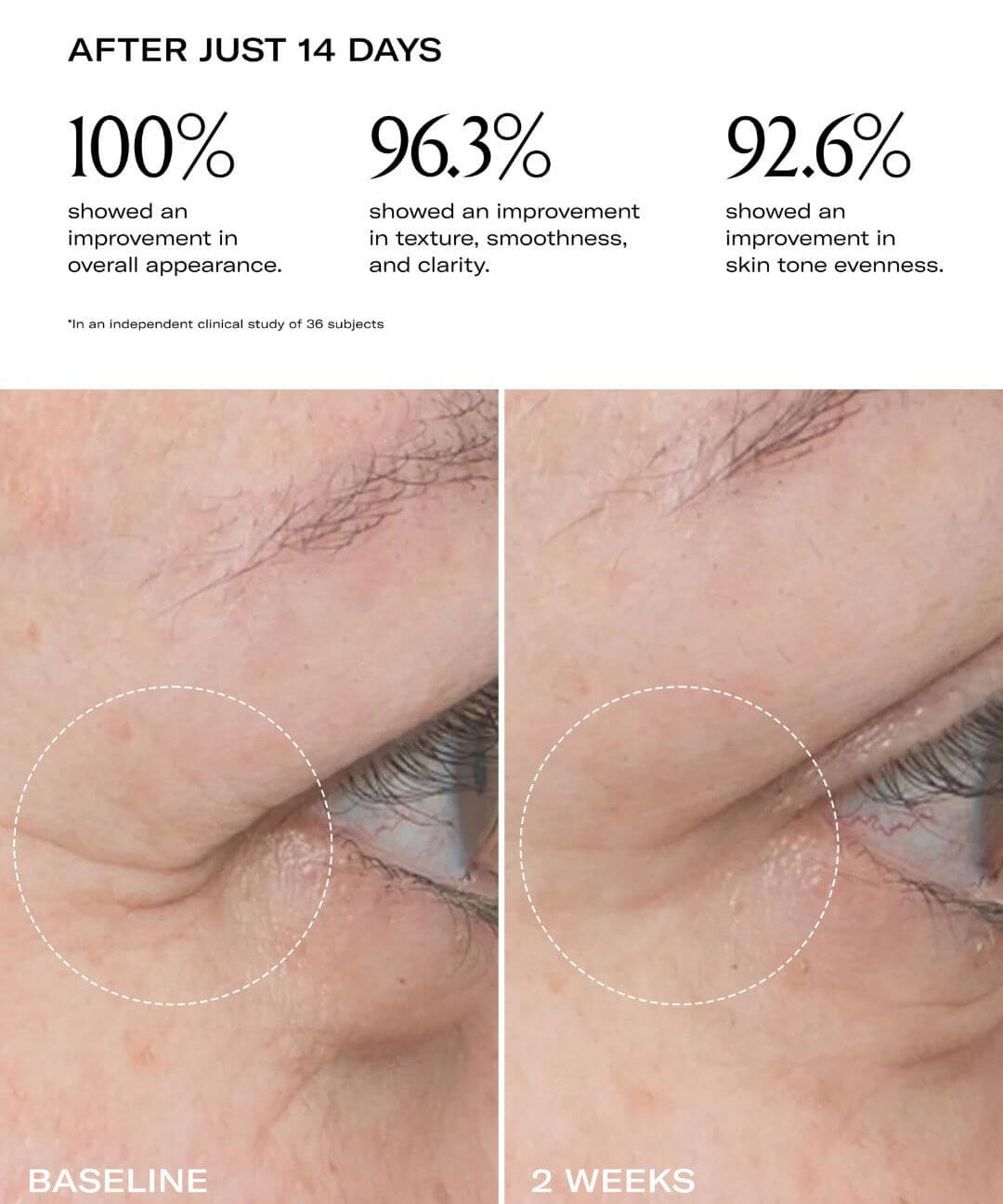 Le Prunier Plum Oil before and after eyes