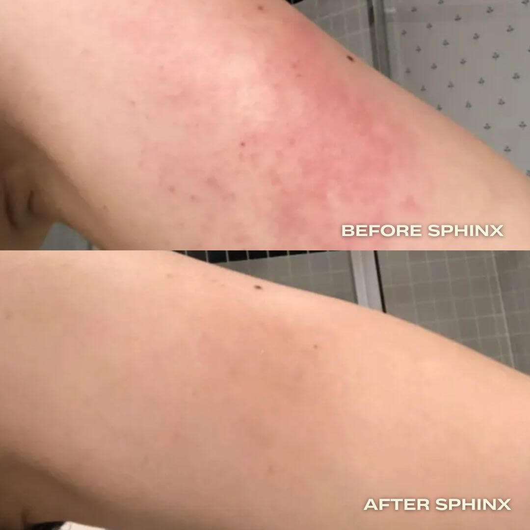 Before and after comparison of a person's leg with 'Before Sphinx' and 'After Sphinx' body oil from Luna Nectar.