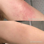 Before and after comparison of a person's leg with 'Before Sphinx' and 'After Sphinx' body oil from Luna Nectar.