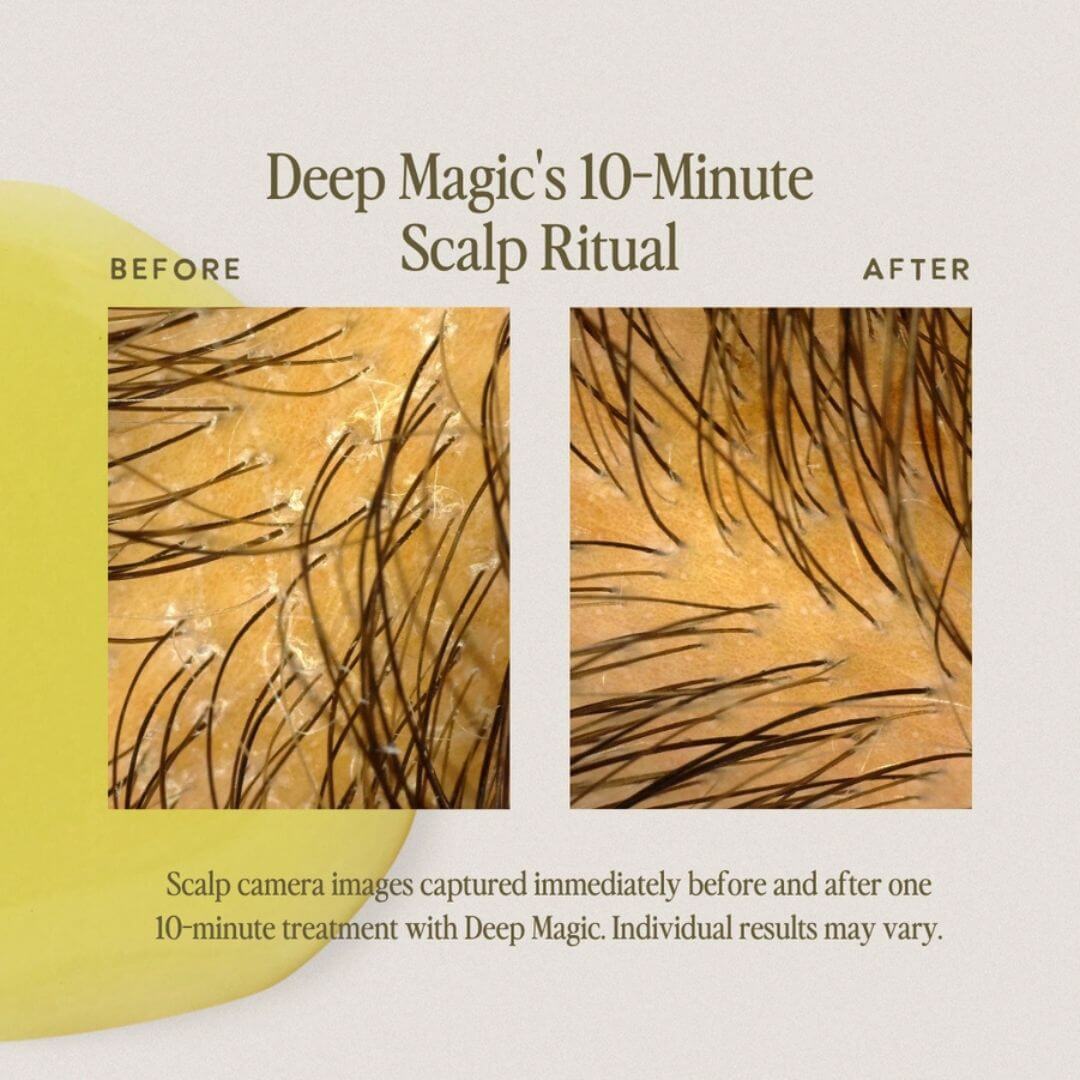 Before and after comparison graphic for Deep Magic's 10-Minute Scalp Ritual, showing close-up scalp camera images of hair density and scalp texture, with explanatory text on a beige background.