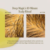Before and after comparison graphic for Deep Magic's 10-Minute Scalp Ritual, showing close-up scalp camera images of hair density and scalp texture, with explanatory text on a beige background.