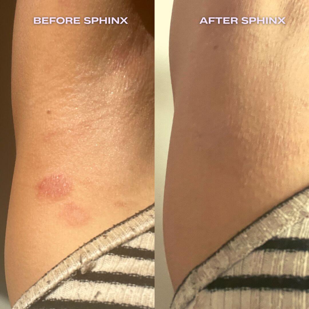 Before and after comparison of Luna Nectar Boy Oil on a person's arm labeled 'Before Sphinx' and 'After Sphinx'.