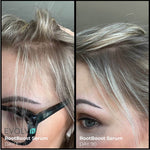 Before and after comparison of hair growth using RootBoost Serum on a person's head.