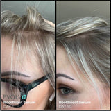 Before and after comparison of hair growth using RootBoost Serum on a person's head.