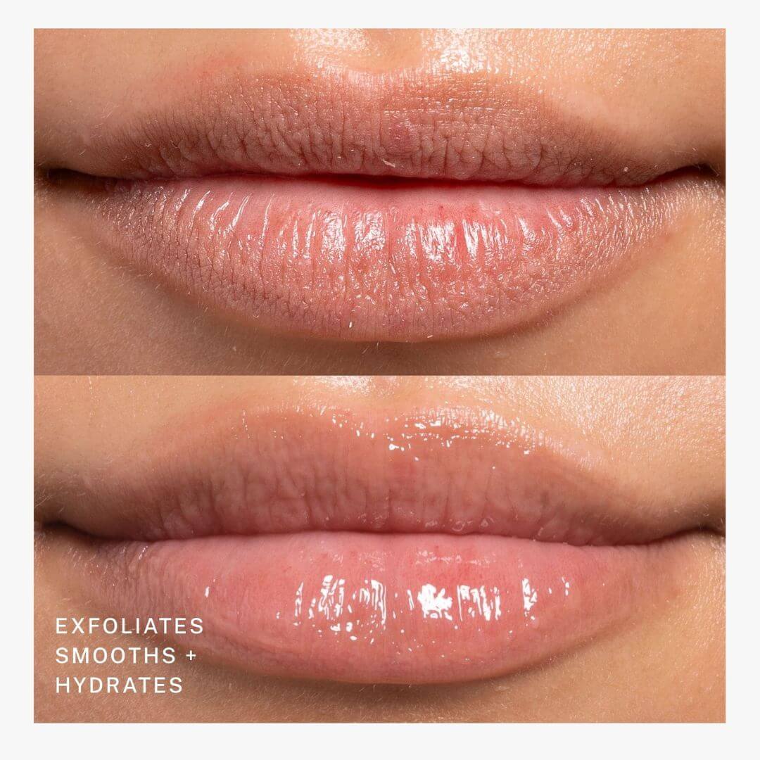 Before and after comparison of lips with exfoliating and hydrating effects.