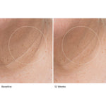Le Prunier Plumbody Results on wrinkles at 12 weeks