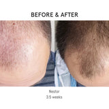 Luna Nectar Atmosphere Hair Serum Before and After Nestor