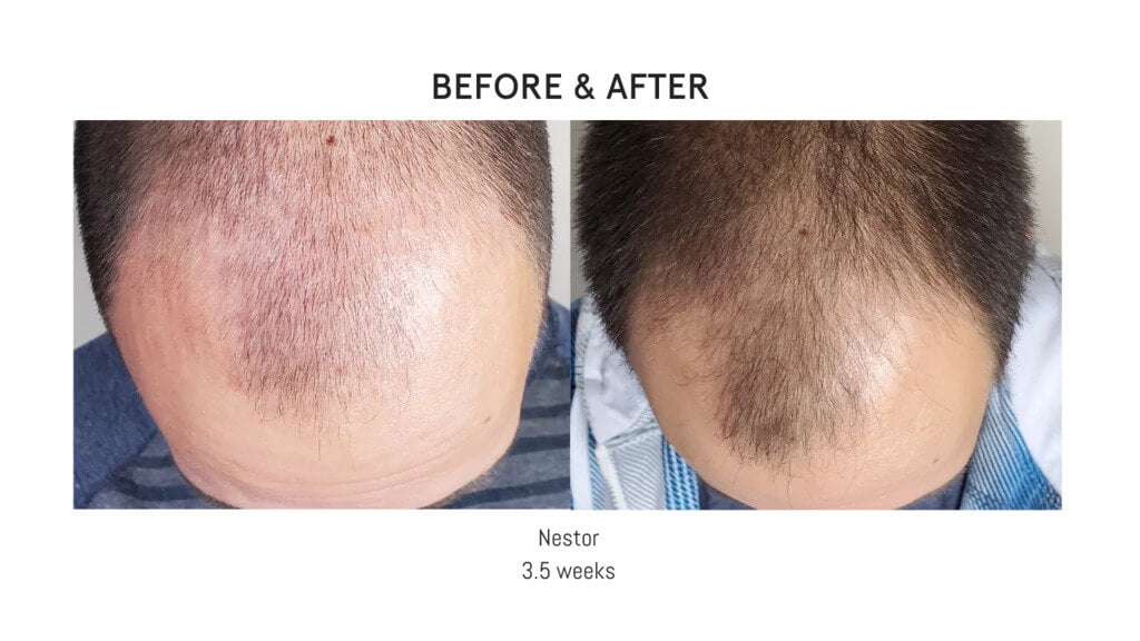 Luna Nectar Atmosphere Hair Serum Before and After Nestor